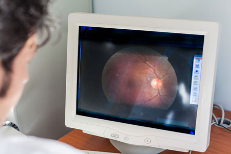 Retina Disorders treated by Medical Eye Associates, Complete Vision Care in Wilson and Rocky Mount, NC